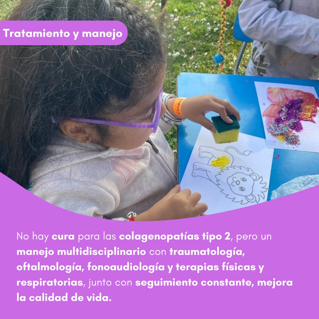 FUCOLCH's tweet photo. Hablemos de... Colagenopatías tipo 2 🧬 #ColagenopatíasTipoII #TallaBaja #SíndromeDeStickler #Hipocondrogénesis #DisplasiasEsqueléticas #EnfermedadesRaras #FundaciónFucolch #Visibilización #Acompañamiento #Concientización https://t.co/ZYosh8iFhf