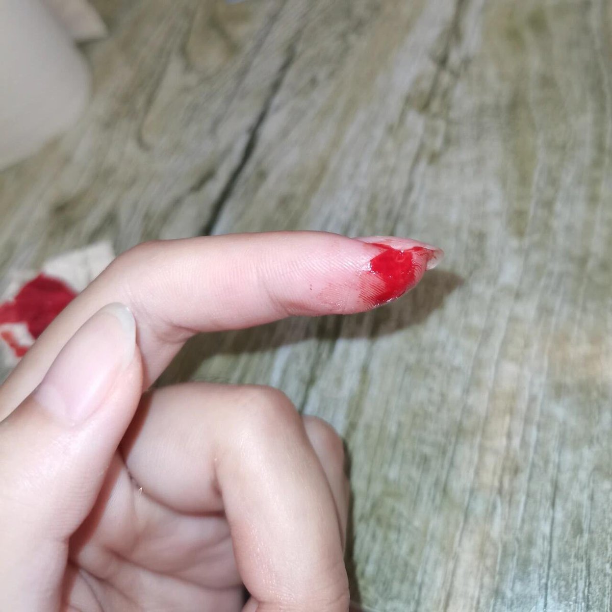 jayceee04's tweet image. I accidentally cut my hand while cutting vegetables.