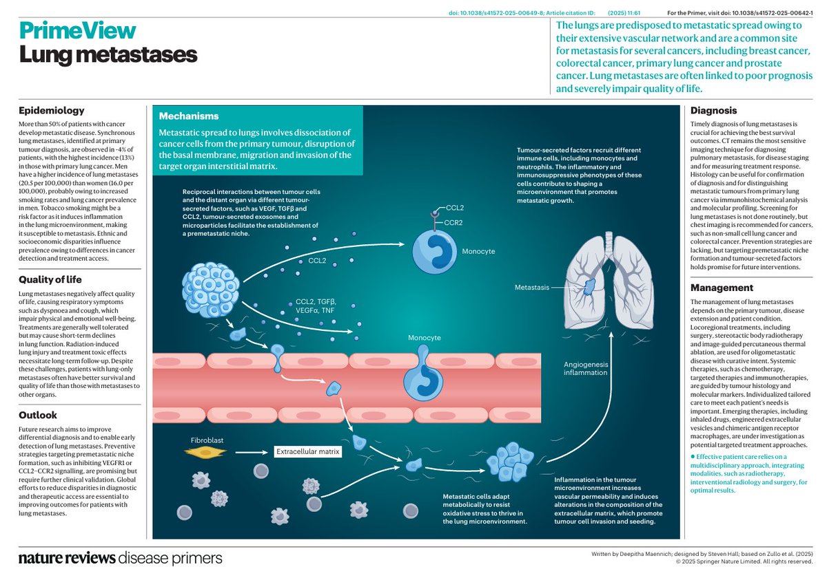 Get Primed on Lung metastases with our NEW PrimeView! FREE to download this week! nature.com/articles/s4157…