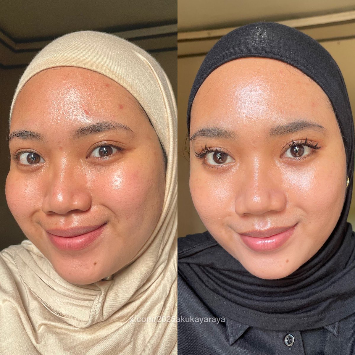 2026akukayaraya's tweet image. Cuma semingguan kulit ga cuma jadi cerah tapi CERAH BANGET + bonus dark spot memudar✨

Aku spill dibawah, janji ya payday ini harus jajan😠🫵