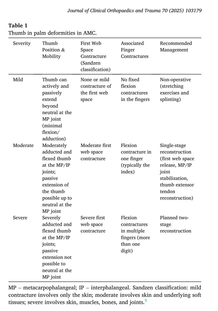 Terrence Jose Jerome, FRCS (@terrencejose) on Twitter photo Thumb-in-Palm deformity in AMC
1. New severity-based classification (Mild–Moderate–Severe)
2.Modified outcome score
3.Treatment algorithm
sciencedirect.com/science/articl… <a href="/JHandSurg/">J Hand Surg Am- ASSH</a> <a href="/FESSHEurope/">FESSH</a> <a href="/JHSEur/">The Journal of Hand Surgery (European Volume)</a> <a href="/prsjournal/">Plastic and Reconstructive Surgery</a> <a href="/PRSGlobalOpen/">PRS Global Open</a> <a href="/jbjs/">J Bone & Joint Surg</a> <a href="/BoneJointJ/">The Bone & Joint Journal</a> <a href="/AAOS1/">AAOS</a> <a href="/SICOTortho/">SICOT</a> <a href="/HandSurgeryAssn/">AAHS</a> Thumb-in-Palm deformity in AMC
1. New severity-based classification (Mild–Moderate–Severe)
2.Modified outcome score
3.Treatment algorithm
sciencedirect.com/science/articl… <a href="/JHandSurg/">J Hand Surg Am- ASSH</a> <a href="/FESSHEurope/">FESSH</a> <a href="/JHSEur/">The Journal of Hand Surgery (European Volume)</a> <a href="/prsjournal/">Plastic and Reconstructive Surgery</a> <a href="/PRSGlobalOpen/">PRS Global Open</a> <a href="/jbjs/">J Bone & Joint Surg</a> <a href="/BoneJointJ/">The Bone & Joint Journal</a> <a href="/AAOS1/">AAOS</a> <a href="/SICOTortho/">SICOT</a> <a href="/HandSurgeryAssn/">AAHS</a>