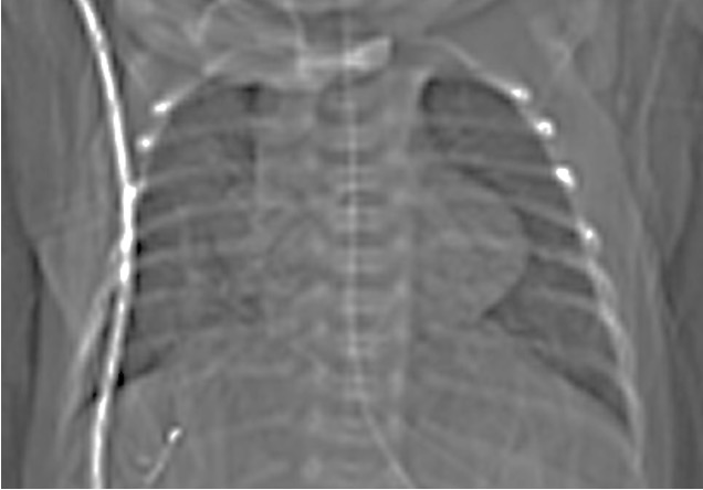 David Tingay tweet media