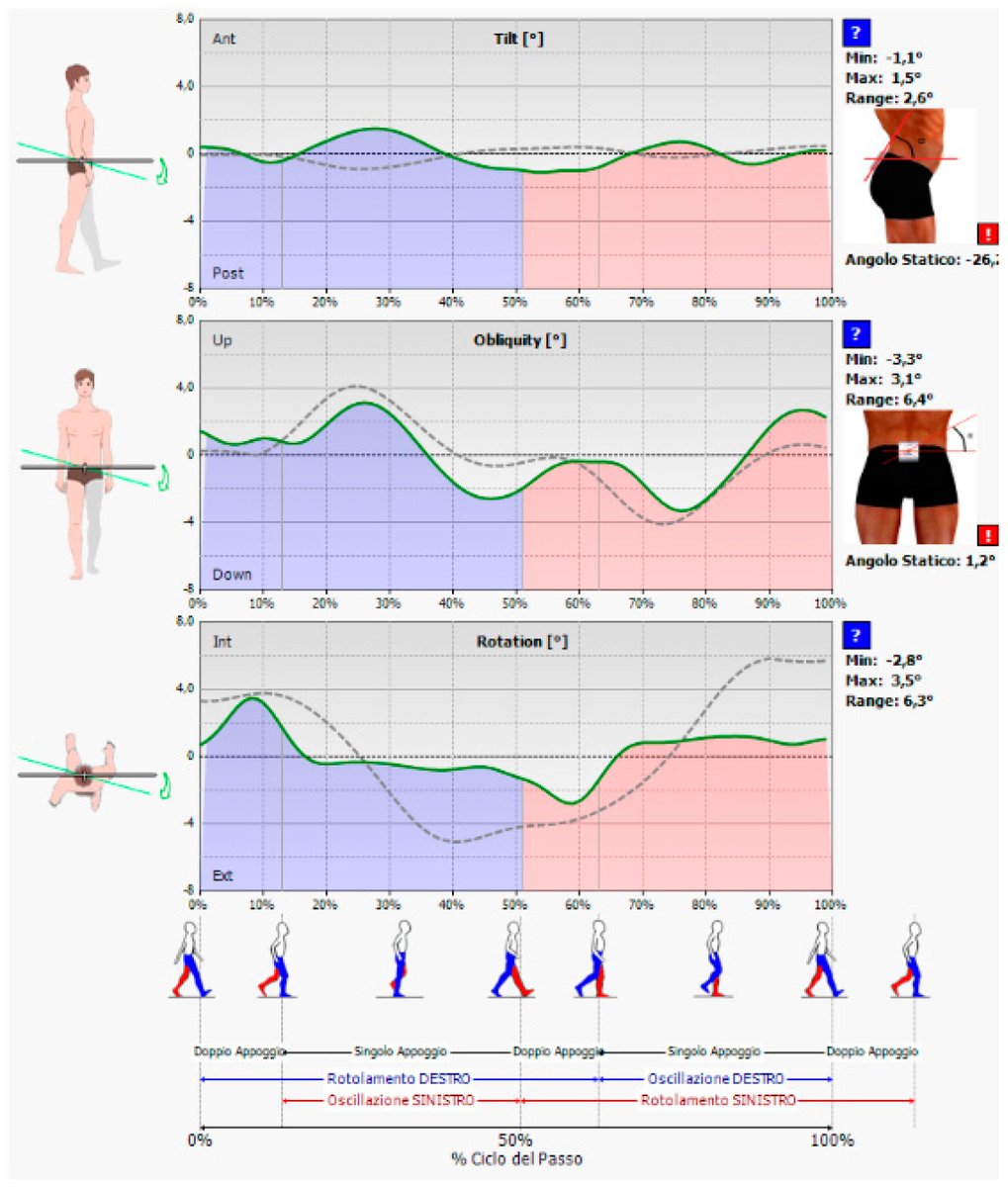 Applied Sciences MDPI (@applsci) on Twitter photo 🔥 Read our Highly Cited Paper
📚 An Innovative Clinical Evaluation Protocol after #TotalAnkleArthroplasty: A Pilot Study Using #InertialSensors and Baropodometric Platforms
🔗 mdpi.com/2076-3417/14/5…
👨🔬 Antonio Mazzotti et al.
🏫 <a href="/IRCCS_Rizzoli/">Rizzoli IRCCS</a> / <a href="/Unibo/">Università di Bologna</a>
#gaitanalysis 🔥 Read our Highly Cited Paper
📚 An Innovative Clinical Evaluation Protocol after #TotalAnkleArthroplasty: A Pilot Study Using #InertialSensors and Baropodometric Platforms
🔗 mdpi.com/2076-3417/14/5…
👨🔬 Antonio Mazzotti et al.
🏫 <a href="/IRCCS_Rizzoli/">Rizzoli IRCCS</a> / <a href="/Unibo/">Università di Bologna</a>
#gaitanalysis