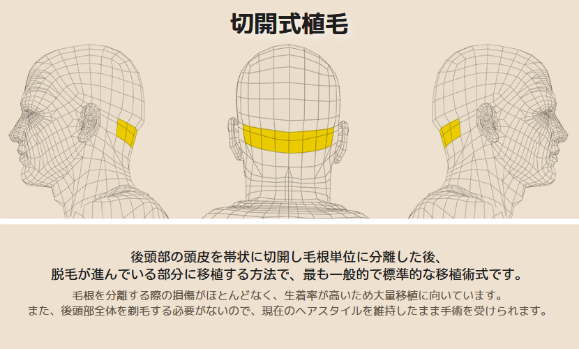 モアマン医院 tweet media