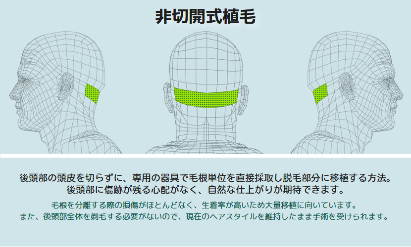 モアマン医院 tweet media