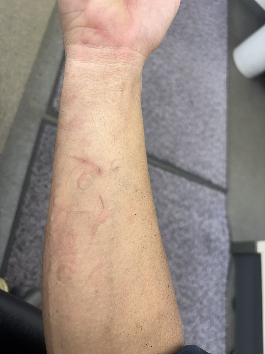 ホンダ車を修理するとはこういうことです。

ってのはわかる写真あります？笑