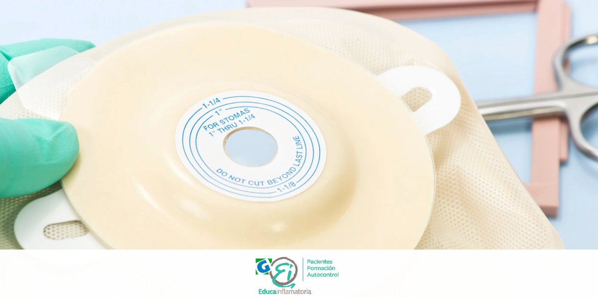 G-EducaInflamatoria (@entrenaeii) on Twitter photo Tras una cirugía intestinal o si llevas una ostomía (sobre todo ileostomía), la fibra debe reintroducirse poco a poco. Comienza con alimentos muy bien cocinados, sin pieles ni semillas, y aumenta gradualmente según tolerancia y seguimiento profesional Tras una cirugía intestinal o si llevas una ostomía (sobre todo ileostomía), la fibra debe reintroducirse poco a poco. Comienza con alimentos muy bien cocinados, sin pieles ni semillas, y aumenta gradualmente según tolerancia y seguimiento profesional
