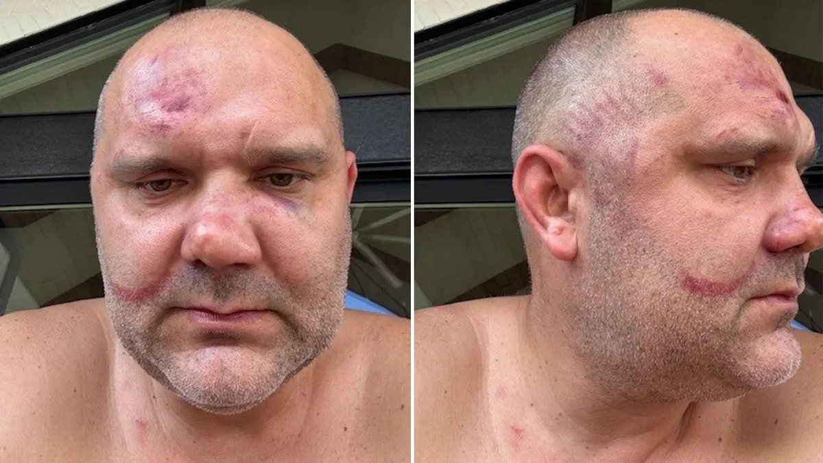 The white man who was brutally attacked by a group of black thugs in Cincinnati, Ohio has been arrested.

They are bringing a criminal case against him, the victim.

You can't make this stuff up.