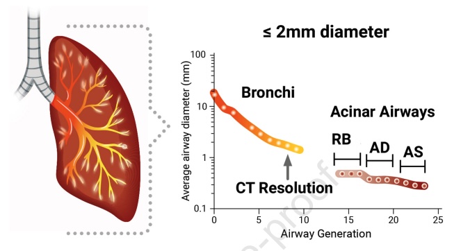 Interasma's tweet image. Detecting #small #airways #dysfunction in #asthma: Rationale, findings, and future of ATLANTIS. Open Access. interasma.org/2025/08/25/det…