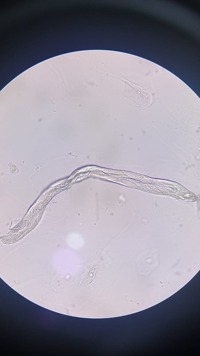 sa90053990's tweet image. عينة بول تحت الماكروسكوب ظهر هذا المنظر 👇🏻 ١) ايش هذا ؟ 
٢) انديكيشن ل ايش ؟ 
الي يجاوب صح بيحصل على دورة مكافحة العدوى مجاني ✨💕