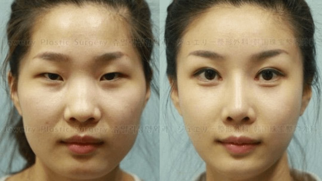 creepydotorg's tweet image. Many Chinese medical tourists who travel to South Korea for affordable, high-quality plastic surgery face difficulties re-entering China because their passport photos no longer match their appearance after the procedure.