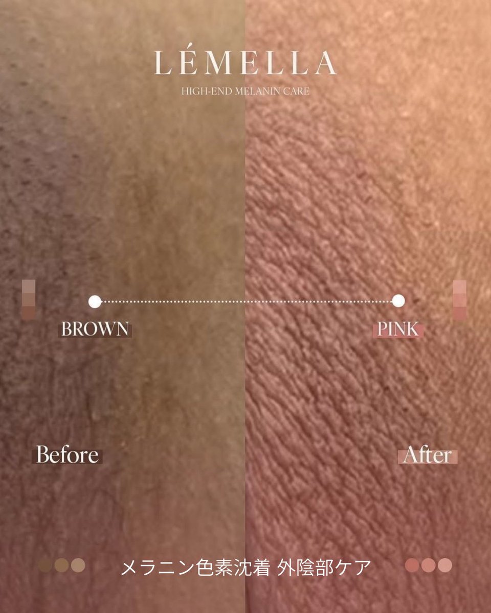 韓国公式】ルメラ (@lemella_jp) / Posts / X