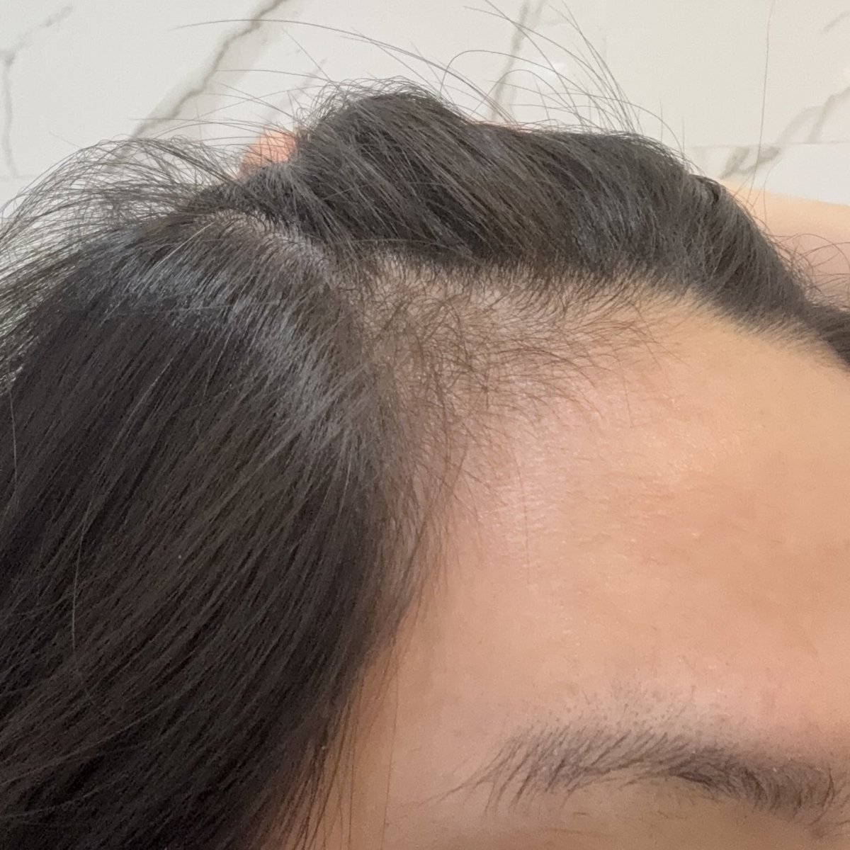 morpormorpaeng's tweet image. เหมือนหน้าม้า แต่เค้าไม่ได้จ้าง 555 รีวิวตามสัตย์จริง เรื่องผมร่วง *ส่วนตัว* เราเฉยๆ ก็ยัวมีร่วงปกติ แต่ลูกผม ฟาร์มผม ความหนา เห็นได้ชัดแบบมากถึงมากที่สุด ไม่ใช่แค่ตัวเอง คนรอบข้างก็ทักว่าผมหนาสวือขึ้นมากๆๆ

เราฉีดทุกครั้งหลังสระผม (สระวันเว้นวัน)
s.shopee.co.th/7ATduhVrsf