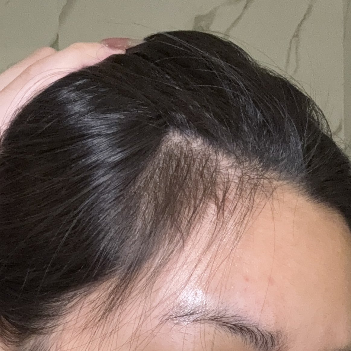 morpormorpaeng's tweet image. เหมือนหน้าม้า แต่เค้าไม่ได้จ้าง 555 รีวิวตามสัตย์จริง เรื่องผมร่วง *ส่วนตัว* เราเฉยๆ ก็ยัวมีร่วงปกติ แต่ลูกผม ฟาร์มผม ความหนา เห็นได้ชัดแบบมากถึงมากที่สุด ไม่ใช่แค่ตัวเอง คนรอบข้างก็ทักว่าผมหนาสวือขึ้นมากๆๆ

เราฉีดทุกครั้งหลังสระผม (สระวันเว้นวัน)
s.shopee.co.th/7ATduhVrsf