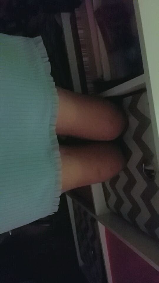 ciinnamairoll's tweet photo. Last one. These are from like 16-18ish. When I turned 18 I started gaining weight rapidly from medications, physical stuff going on and from going from ana to bed 😔 https://t.co/OOuO674caC