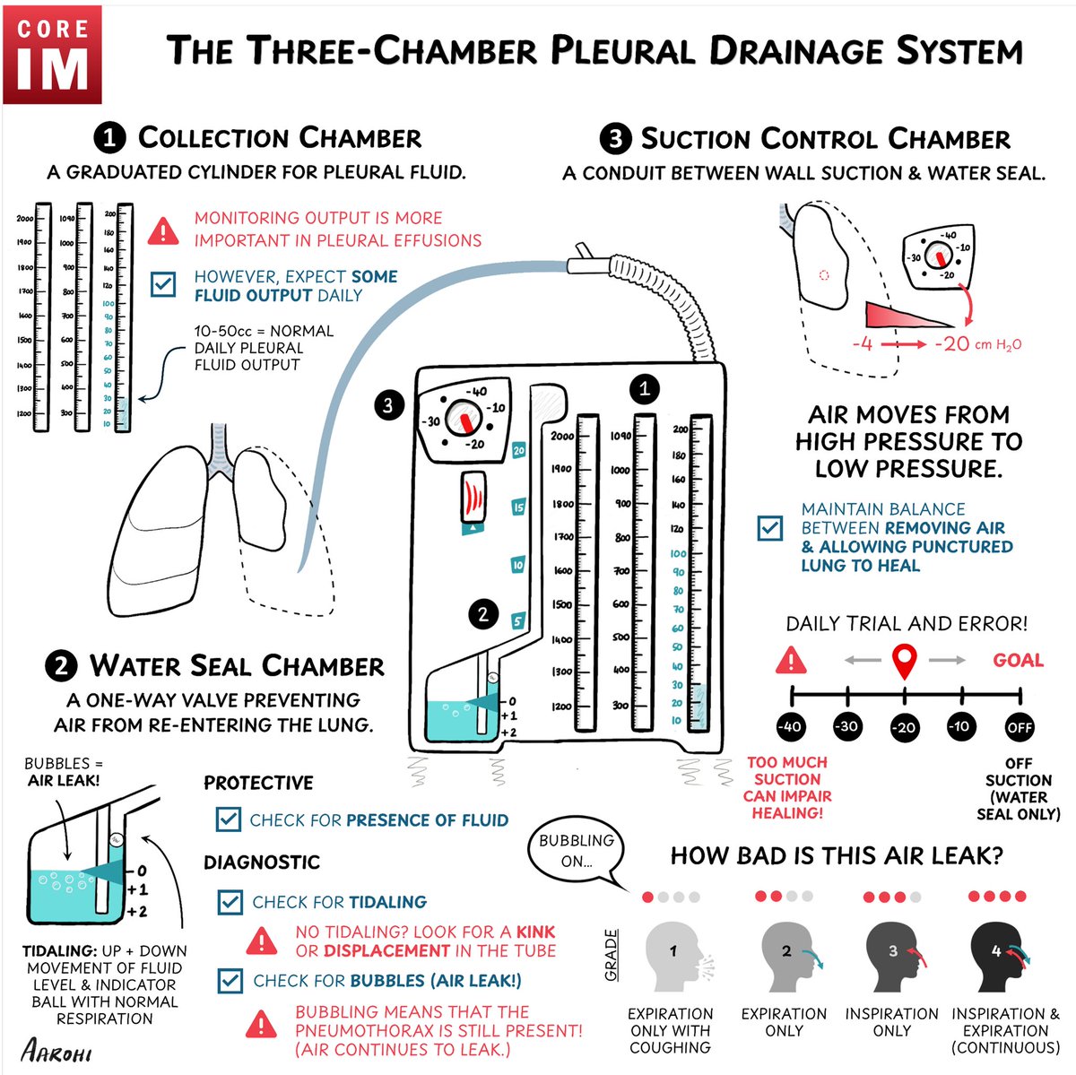COREIMpodcast's tweet image. 1/ 🚨 NEW #5Pearls: Pneumothorax 🫁 

Three tests to diagnose:
1️⃣ CXR
       - Only ~50% sensitive 
2️⃣ POCUS
       - Most sensitive &amp;amp; specific, but user dependent 
3️⃣ CT
       - Gold standard 🏅 

🖥️: coreimpodcast.com/2025/08/25/5-p…