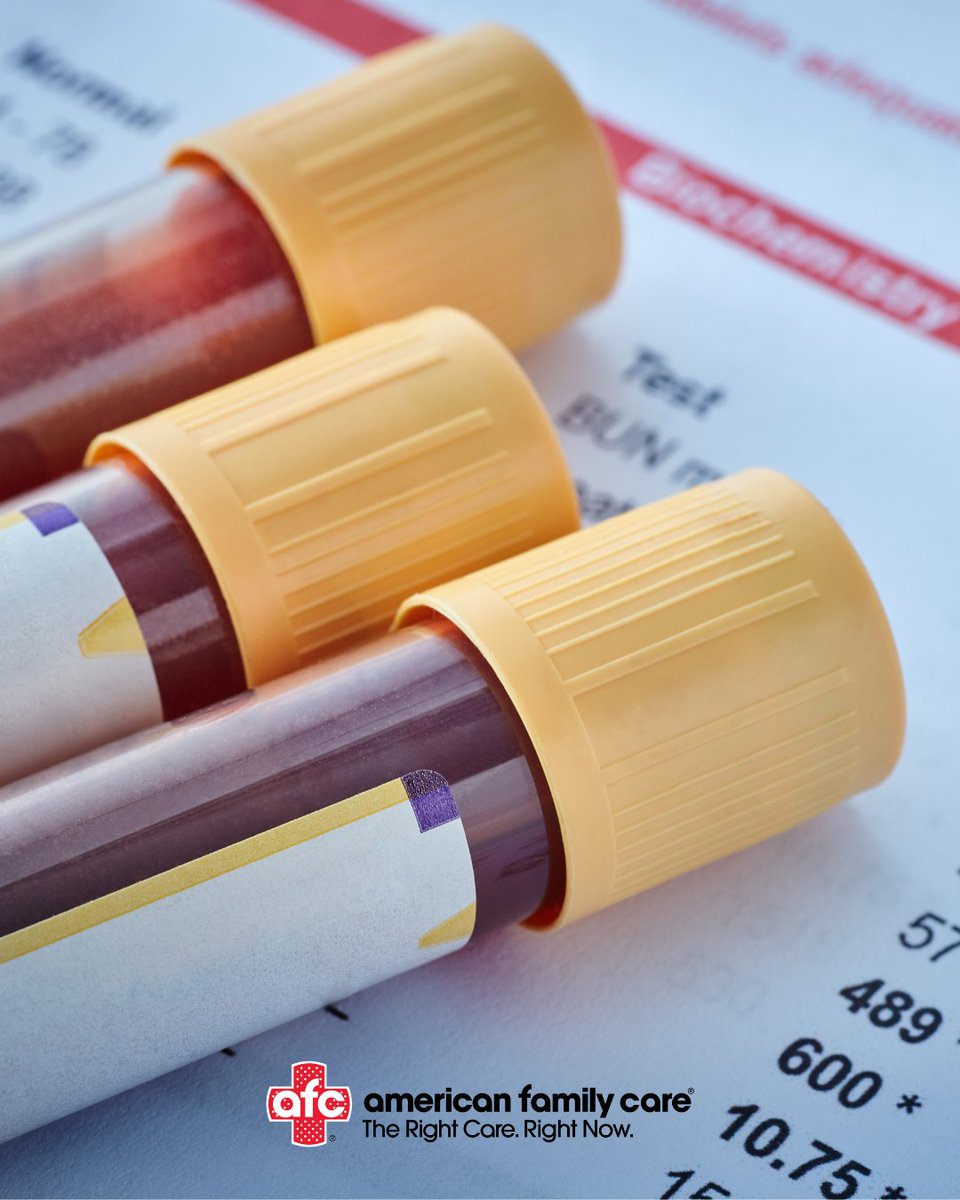 afcprincessanne's tweet image. 🩸 Need bloodwork done? We’ve got you covered! AFC Urgent Care Princess Anne offers routine lab testing, including Comprehensive Metabolic Panels and A1C tests—quick, convenient and close to home.

🌐 | vist.ly/44g9r

#OnSiteLab #AFCUrgentCarePrincessAnne