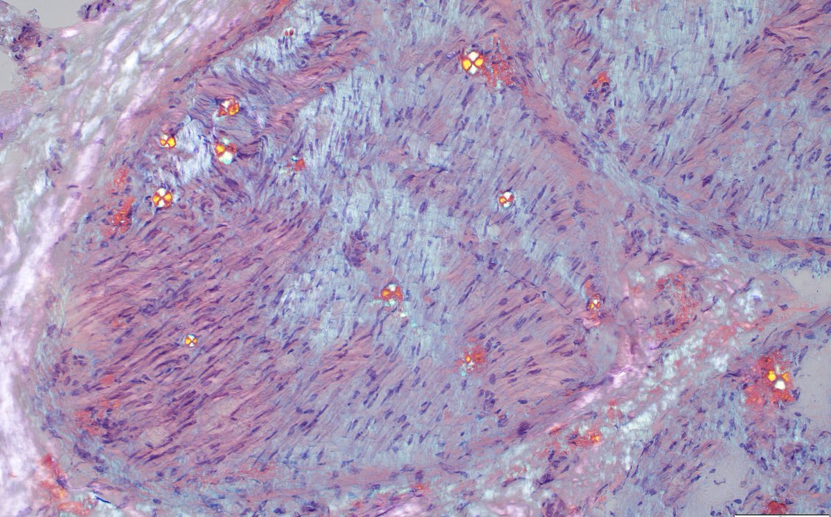 Keith Stockerl-Goldstein, MD 😷 tweet media