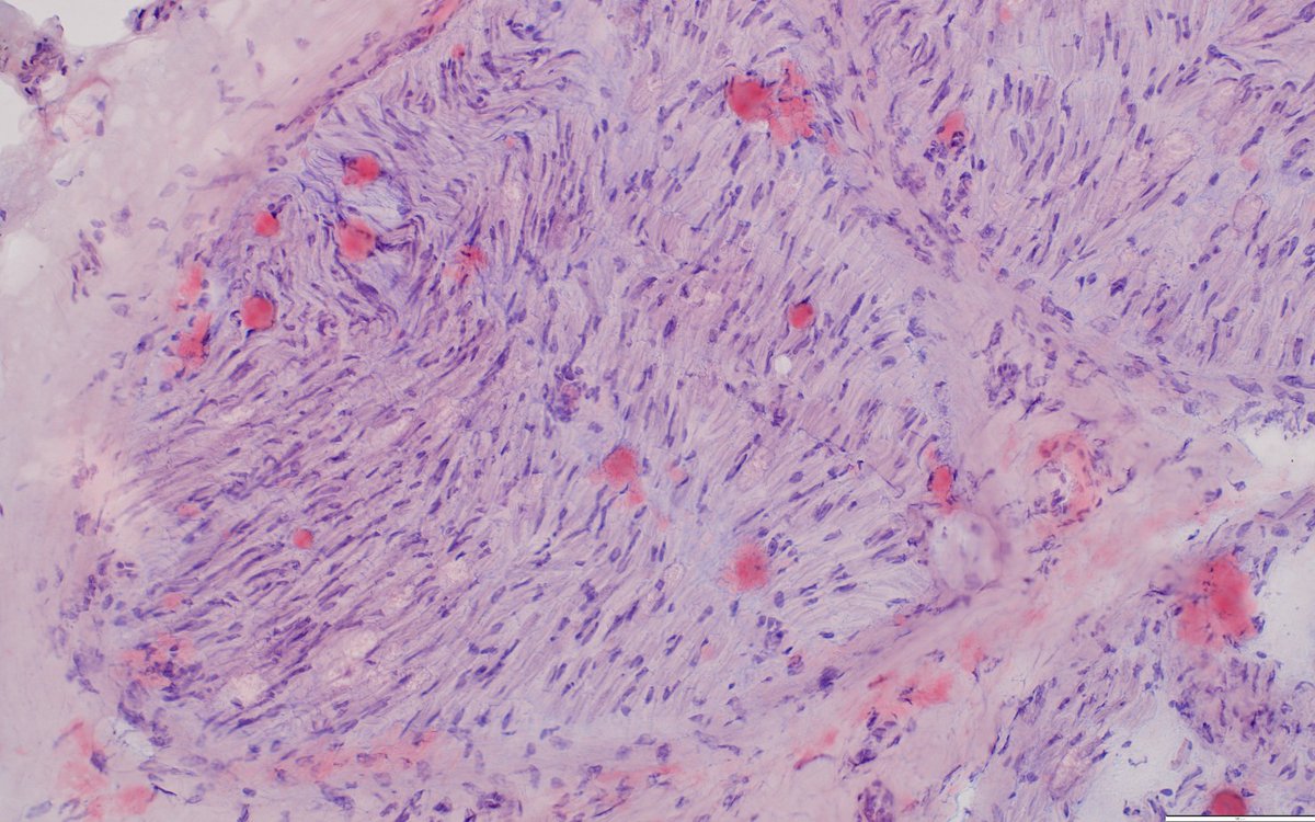 Keith Stockerl-Goldstein, MD 😷 tweet media