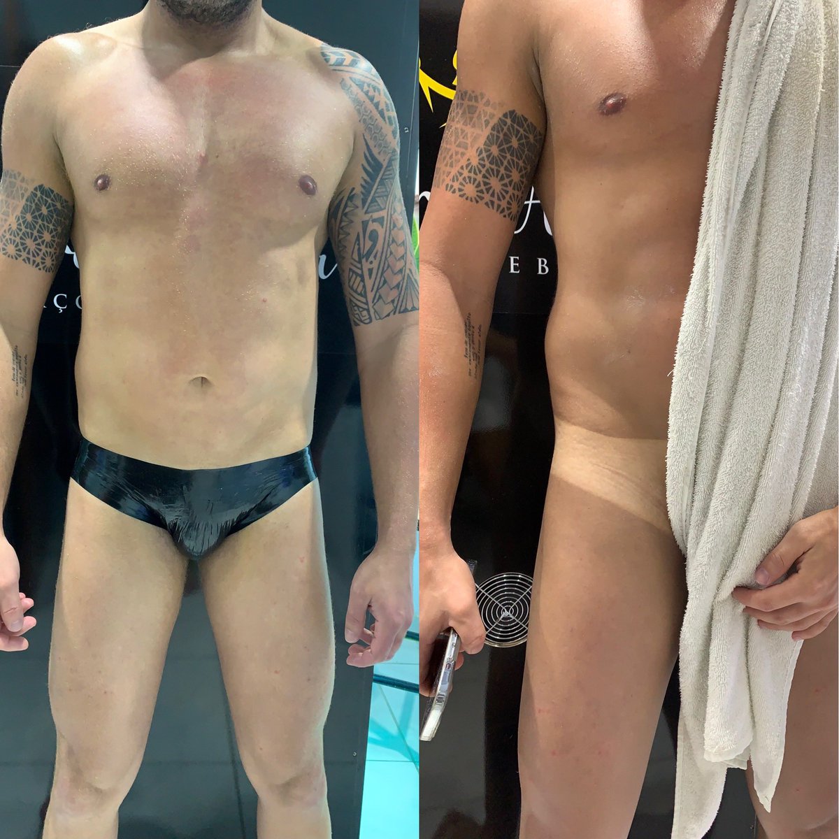 Mais um resultado incrível olha a cor da pele o antes e o depois a pele bronzeada uma pele praiana 🔥