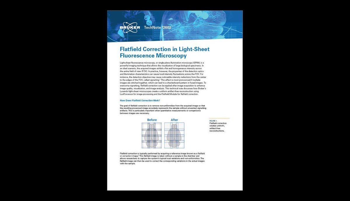 luxendo's tweet image. 🔬 Flatfield Correction in Light-Sheet Fluorescence Microscopy

In this technical note:
🔹 The purpose of flatfield correction
🔹 Steps to take for applying flatfield correction
🔹 Application example

🔗 buff.ly/3AM50Un
 
#lsfm #spim #lightsheet #microscopy