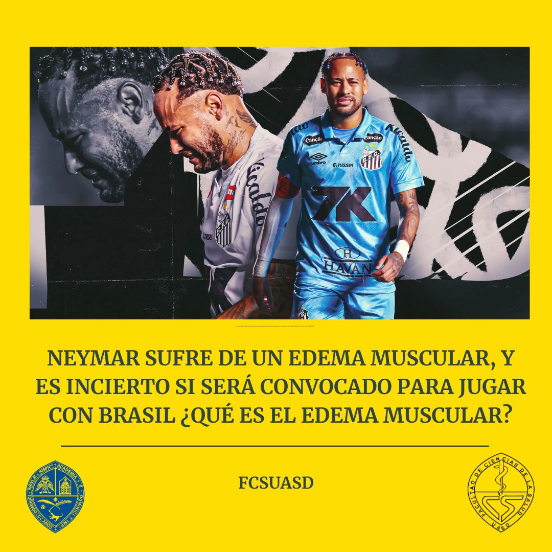 Facultad de Ciencias de la Salud (UASD) (@uasdfcs) on Twitter photo <a href="/neymarjr/">Neymar Jr</a> sufre de un edema muscular, y es incierto si será convocado para jugar con Brasil ¿Qué es el edema muscular?
facebook.com/photo/?fbid=82…
#neymar #neymarjr #NeymarJr10 #edemamuscular #brasil #futbol #UASD #FCS <a href="/JLMendoza_/">José Luis Mendoza</a> <a href="/hgomez27/">Héctor Gómez</a> <a href="/Orlandomendez7/">Orlando Méndez es un Show 🎉</a> <a href="/neymarjr/">Neymar Jr</a> sufre de un edema muscular, y es incierto si será convocado para jugar con Brasil ¿Qué es el edema muscular?
facebook.com/photo/?fbid=82…
#neymar #neymarjr #NeymarJr10 #edemamuscular #brasil #futbol #UASD #FCS <a href="/JLMendoza_/">José Luis Mendoza</a> <a href="/hgomez27/">Héctor Gómez</a> <a href="/Orlandomendez7/">Orlando Méndez es un Show 🎉</a>
