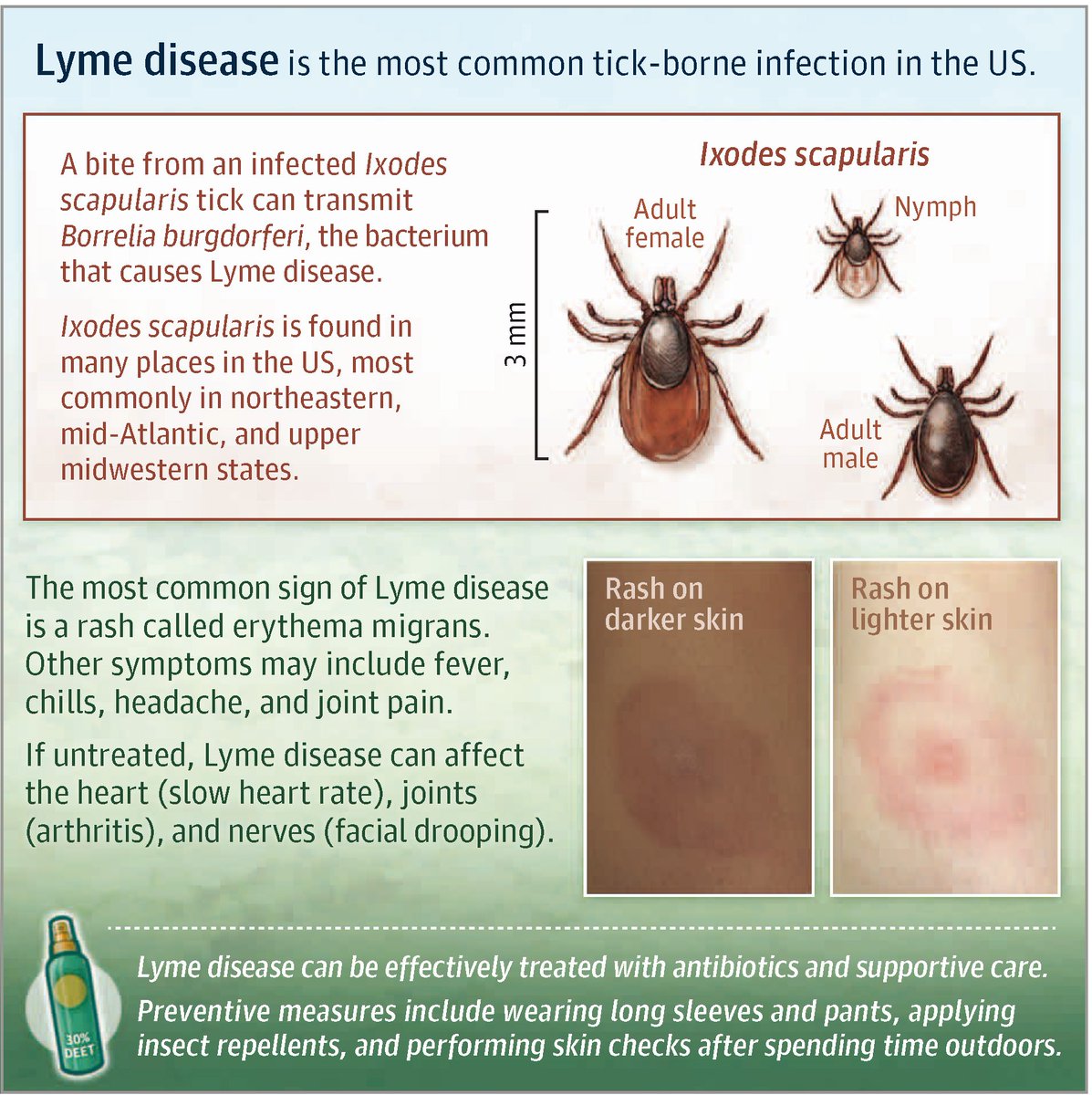 A bite from infected Ixodes scapularis ticks can transmit the bacterium Borrelia burgdorferi, which causes Lyme disease, the most common tick-borne infection in the US. 

This JAMA Patient Page discusses signs, symptoms, and complications of #LymeDisease.