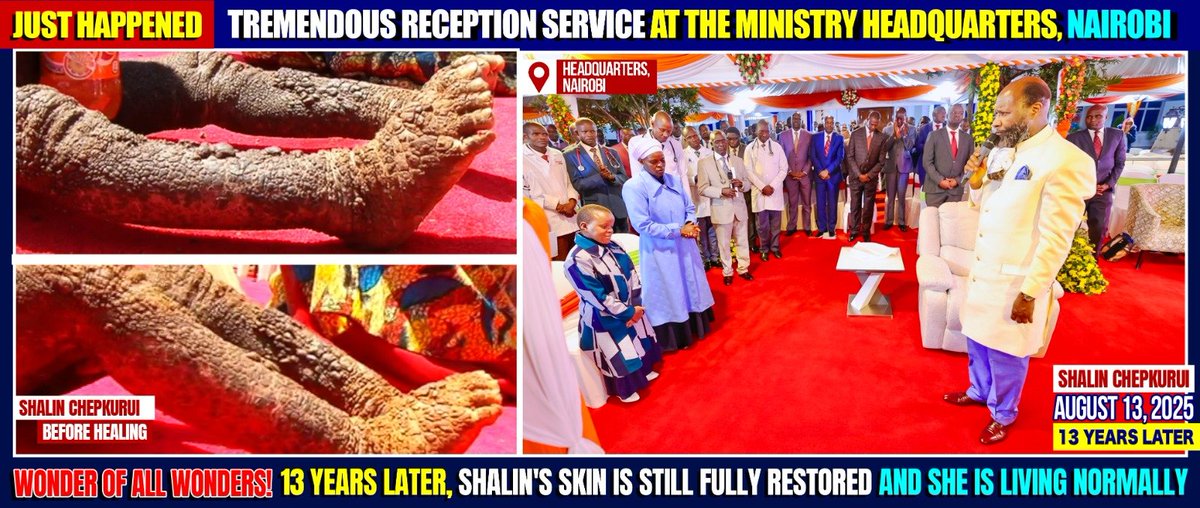 Behold leprosy cleansed upon The DECREE of The Blood of JESUS by The Prophet of The LORD 

#EternalGospelExploits
