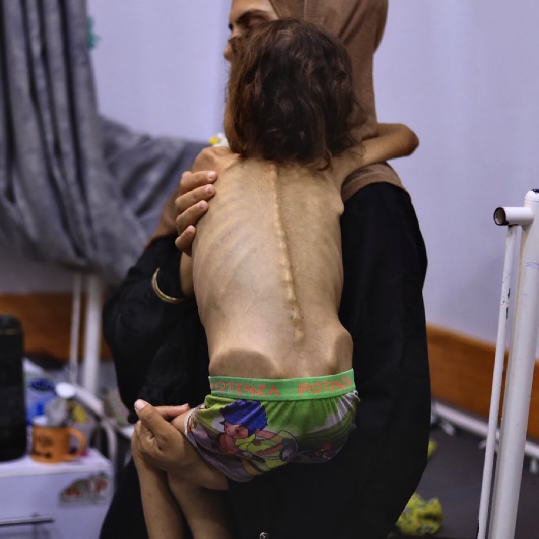 ShaykhSulaiman's tweet image. "The world is seeing famine now, but my daughter has known it for a long time."