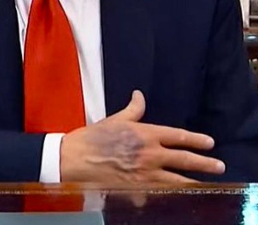 NotAvgLiberal's tweet image. Seriously….

What the fuck is this?

Any medical doctors, nurses….

Can someone please explain this?