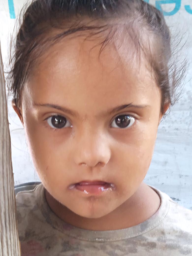 Little Misk is still waiting for her treatment 
Yesterday we asked for $200, but only $50 has arrived so far…
Misk urgently needs the remaining amount for her treatment 
Every donation, no matter how small, makes a big difference 
chuffed.org/project/140167…
<a href="/ireallyhateyou/">B.M.</a>