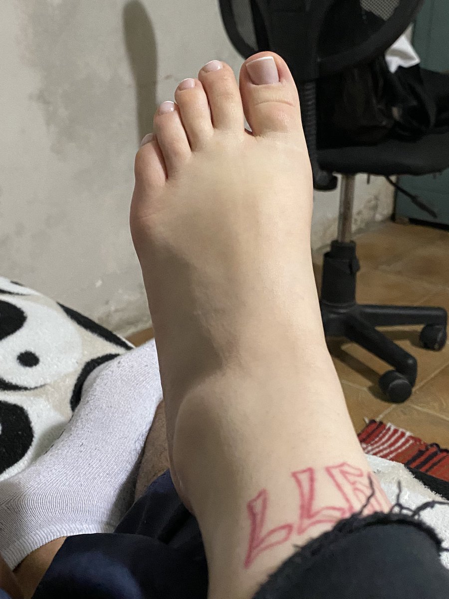 thisloraxz_'s tweet photo. Amo q tem 6 anos q eu tive uma torção fodida no pé e desde então sempre q eu fico mt em pé o meu tornozelo vira isso, e o médico diz q não é ✨NADA✨ https://t.co/10LQ2L54jw