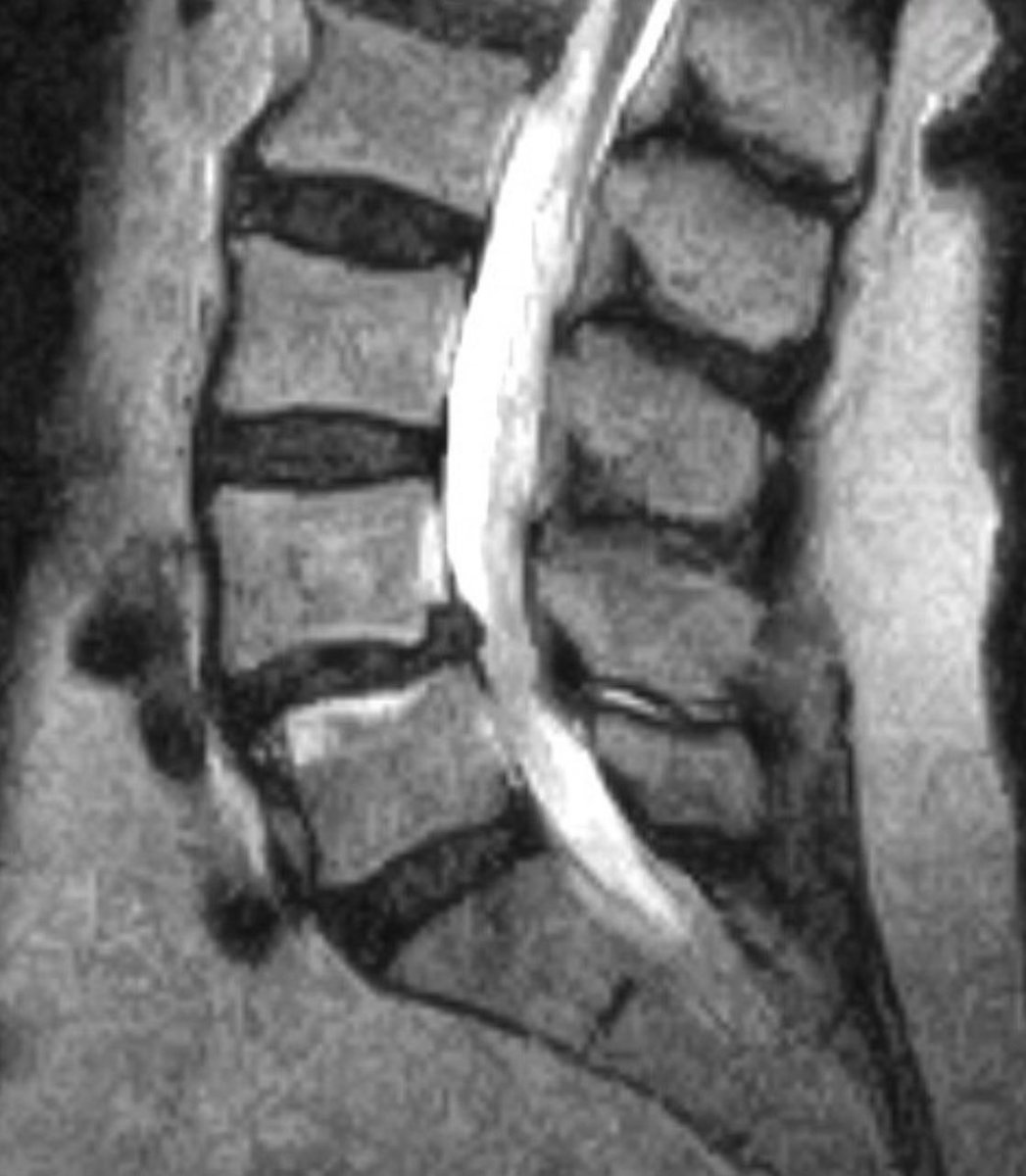 Andrew J. Grossbach, MD, FAANS tweet media