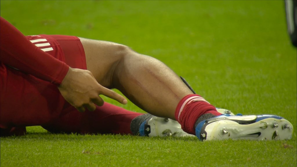 Newcastle fans saying the Anthony Gordon tackle wasn’t a red 😂
#NEWLIV