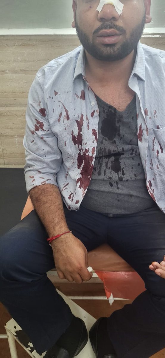 Thevar Steffy (@thevarsteffy) on Twitter photo Car driver's shirt is bloodsoaked & CT scan hints at possible internal bleeding. After spending 3 hrs in khadki police station, only NC filed 'it is not intense enough' for FIR say cops. WHAT DEFINES INTENSITY? <a href="/CPPuneCity/">CP Pune City Police</a> <a href="/PuneCityPolice/">पुणे शहर पोलीस</a> <a href="/ThePuneMirror/">Pune Mirror</a> <a href="/pulse_pune/">Pune Pulse</a> <a href="/punekarnews/">Punekar News</a> Car driver's shirt is bloodsoaked & CT scan hints at possible internal bleeding. After spending 3 hrs in khadki police station, only NC filed 'it is not intense enough' for FIR say cops. WHAT DEFINES INTENSITY? <a href="/CPPuneCity/">CP Pune City Police</a> <a href="/PuneCityPolice/">पुणे शहर पोलीस</a> <a href="/ThePuneMirror/">Pune Mirror</a> <a href="/pulse_pune/">Pune Pulse</a> <a href="/punekarnews/">Punekar News</a>