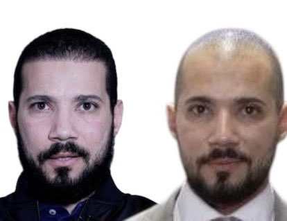 الراجل اللي بيزرع شعر