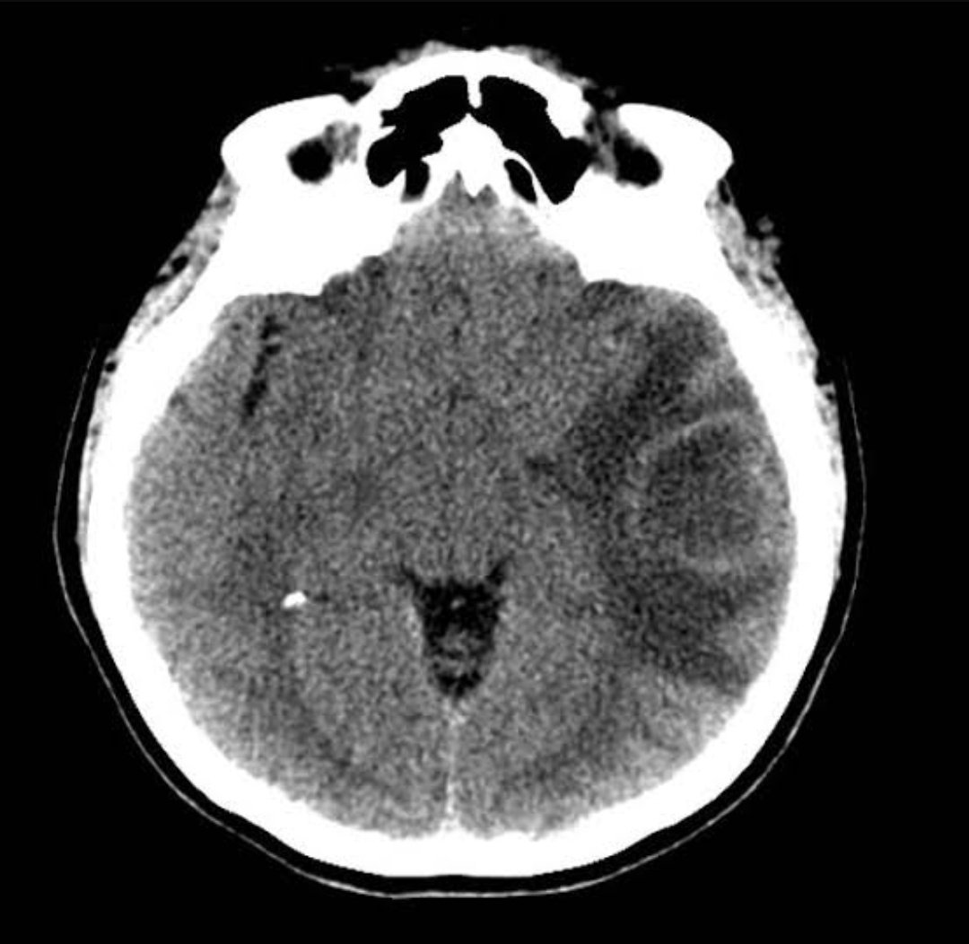 Neuromed tweet media