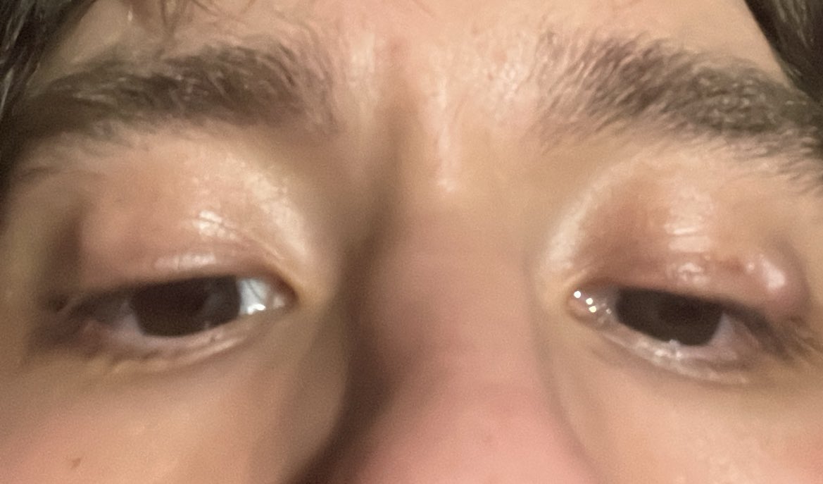 sincarisma__'s tweet photo. yo ando siii  funciones todas las semanas, ensayo acá, ensayo allá, doy clases, corro para todos lados. mis ojos: https://t.co/mONnVUL6oy