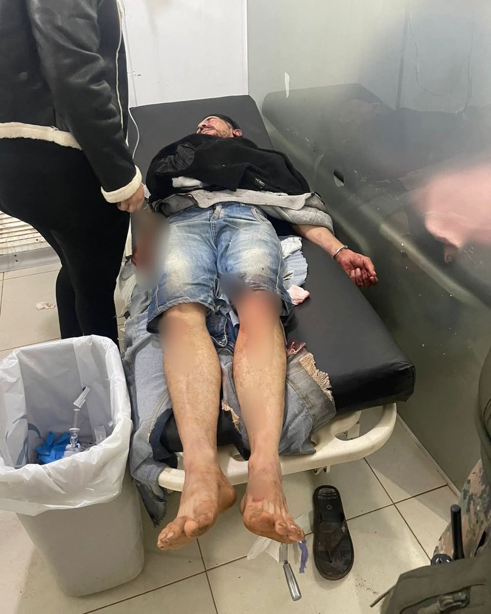 📍#ATENCIÓN— Feminicidio en Concepción: Una joven fue asesinada por su pareja en un acto de extrema violencia

🚨 Un nuevo caso de feminicidio ha sacudido este lunes a la ciudad de Concepción, dejando a la comunidad sumida en el dolor y la indignación, tras el brutal crimen de