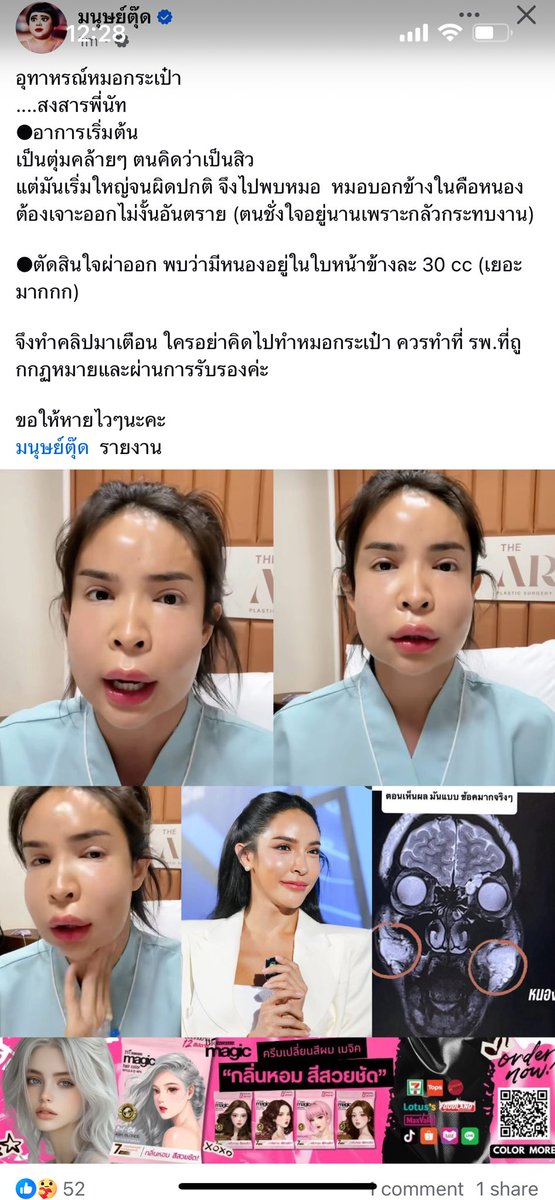 งงในงงทำไมถึงกล้า ใดใดคือหายไวไว