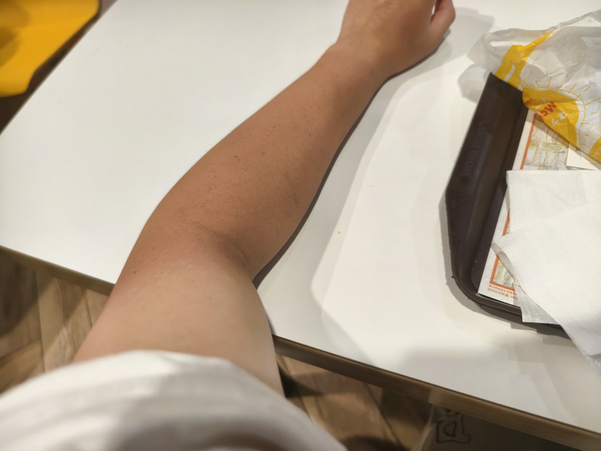 My whole arm become different coloring 🥹