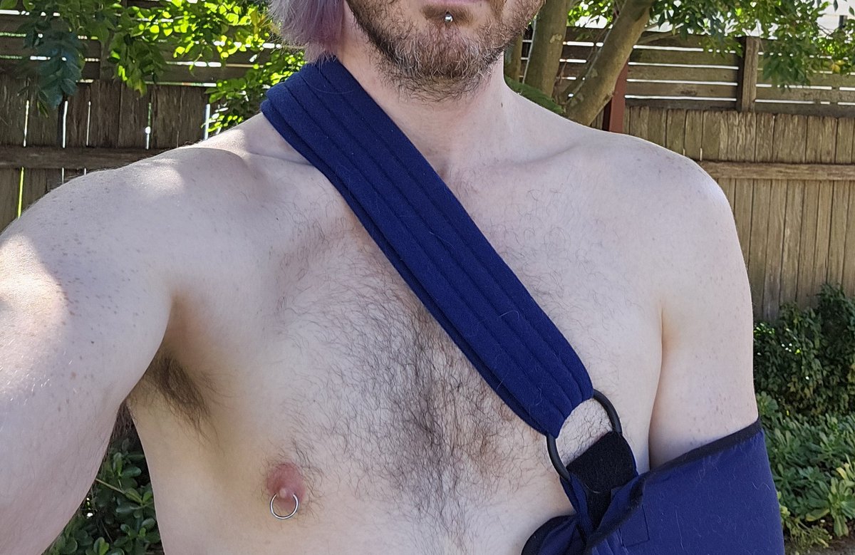 Dislocated shoulder says hi!
Hoping I'm good for red rave next weekend 💀
Send sympathy nudes? 🥺