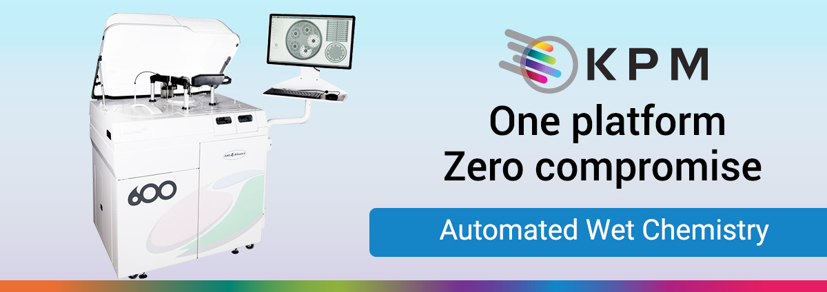 KPM_Analytics's tweet image. 𝗦𝗺𝗮𝗿𝘁𝗖𝗵𝗲𝗺® 𝟲𝟬𝟬: one platform for speed, automation &amp;amp; compliance.
- Up to 600 tests/hour
- Photometric + EC workflows
- Barcode tracking, auto QC 
- Eco-smart: less water/reagents, reusable cuvettes

Learn more: hubs.la/Q03D97Pc0 

#SmartChem600 #ProcessLab