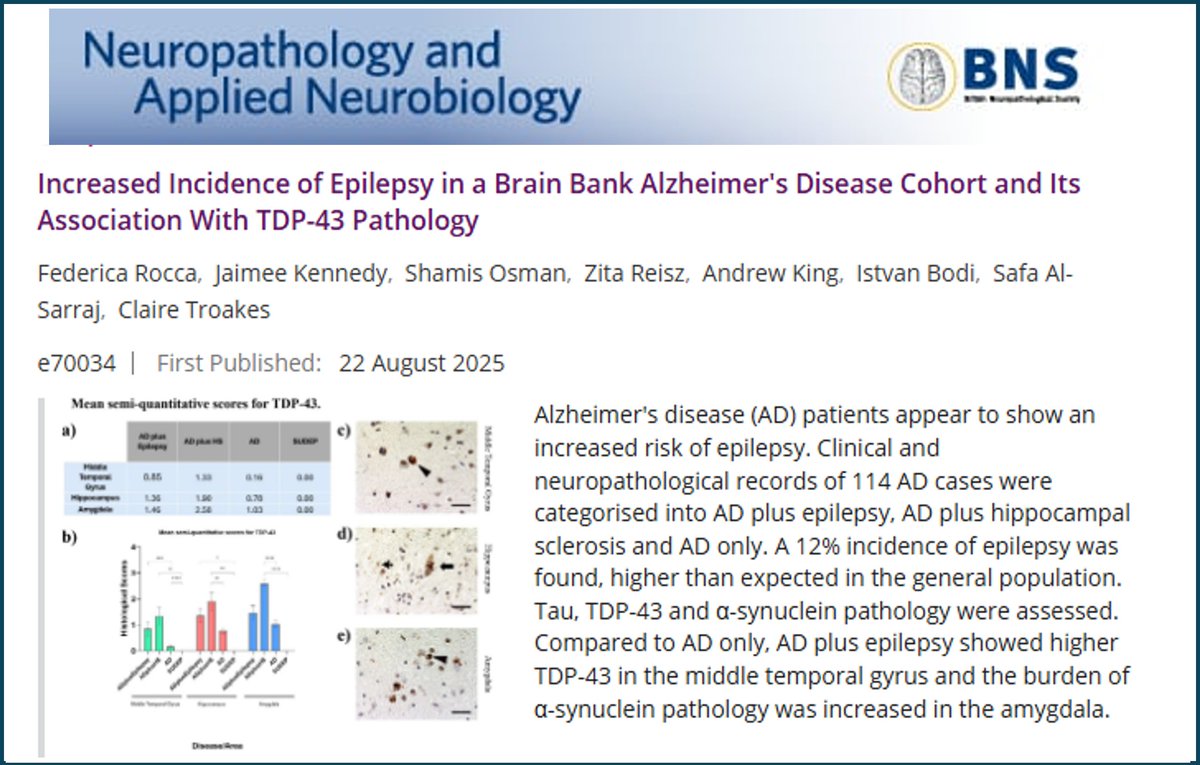London Neurodegenerative Diseases Brain Bank (@lndbrainbank) on Twitter photo New Brain Bank paper! Delighted to see this paper published - based on an observation from our clinical records and initially carried out as an MSc project - a great team effort now published in our favourite journal 🙂<a href="/LNDBrainBank/">London Neurodegenerative Diseases Brain Bank</a> <a href="/NAN_Wiley/">NAN</a> #KCLMScNeuroscience New Brain Bank paper! Delighted to see this paper published - based on an observation from our clinical records and initially carried out as an MSc project - a great team effort now published in our favourite journal 🙂<a href="/LNDBrainBank/">London Neurodegenerative Diseases Brain Bank</a> <a href="/NAN_Wiley/">NAN</a> #KCLMScNeuroscience