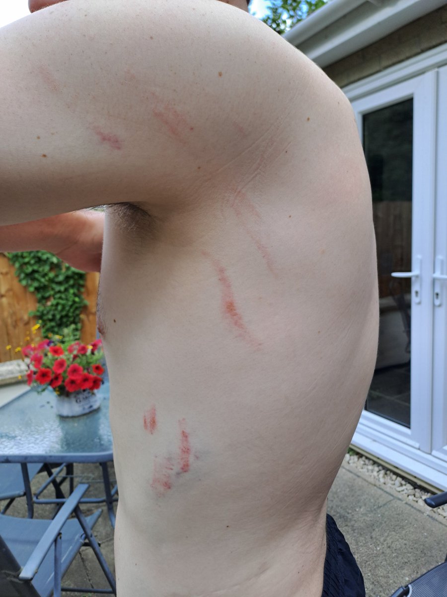 Mark66420167322's tweet image. For all the Uxbridge fans who were  accusing Luke of faking it and it was never a red card for a high boot, Luke is over 6 foot 3....