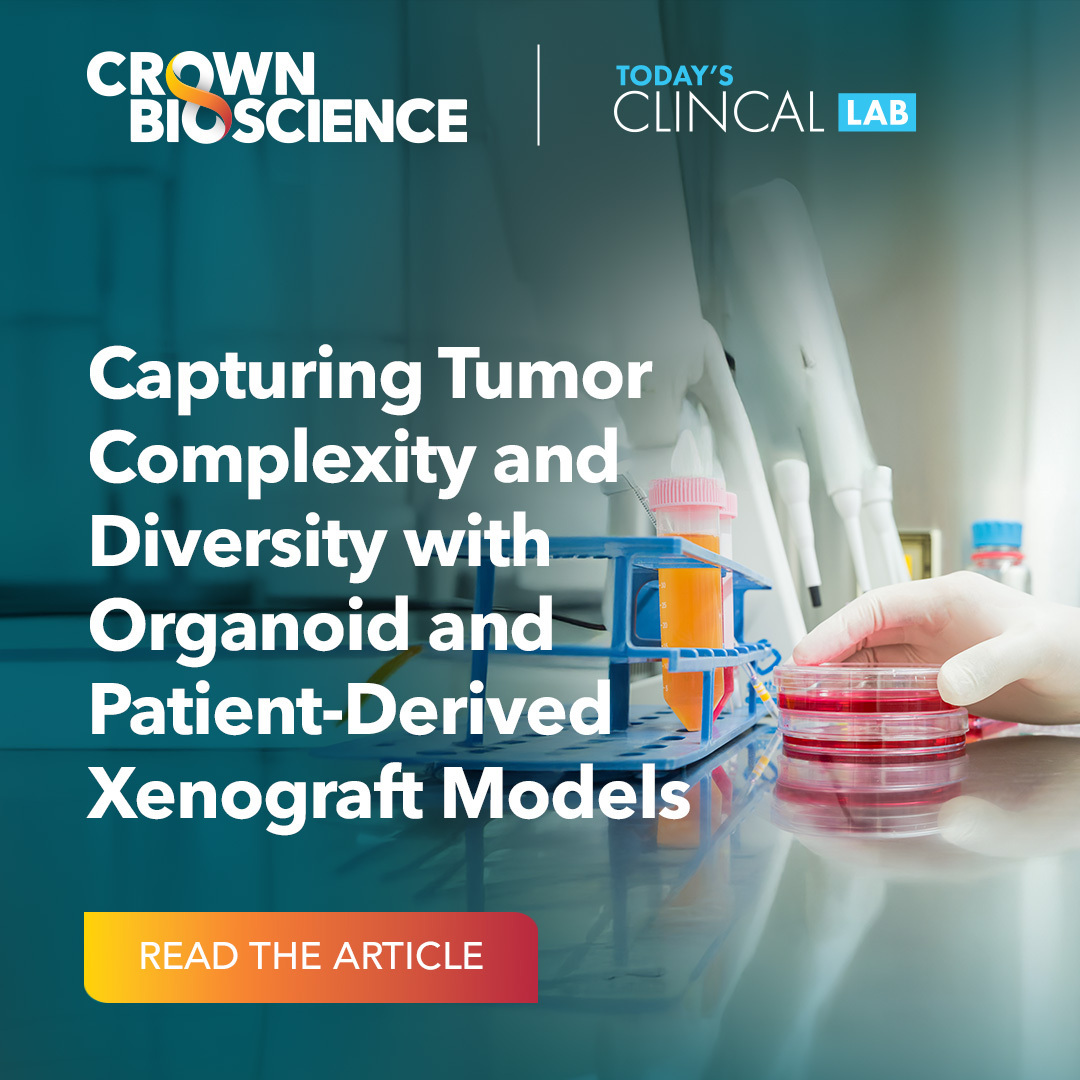 Translational oncology research relies on clinically relevant models that can predict how therapies will perform in patients. By delivering greater biological relevance, patient-derived organoid and xenograft models offer a clearer path.
Learn more:
hubs.la/Q03FrF980