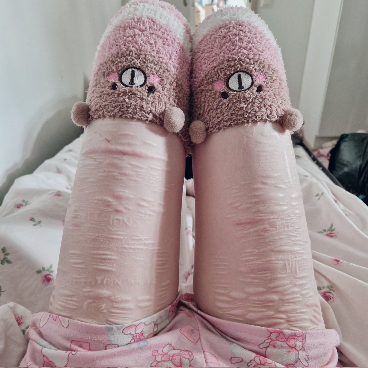 my legs are the hugest bmi 17 I've ever seen

at least they're getting smaller