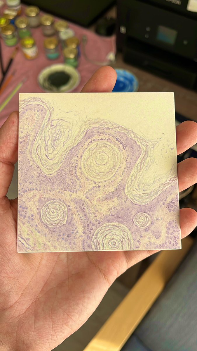 Selim Sürer (@sselim_md) on Twitter photo One of my most detailed pieces yet, and the first in a new dermpath tile series. Soon it will enter the kiln, where for 18 hours fire will shape it into its final form.
#dermpath #pathart #histoart #pathology #histology <a href="/pathologistmag/">The Pathologist</a> One of my most detailed pieces yet, and the first in a new dermpath tile series. Soon it will enter the kiln, where for 18 hours fire will shape it into its final form.
#dermpath #pathart #histoart #pathology #histology <a href="/pathologistmag/">The Pathologist</a>