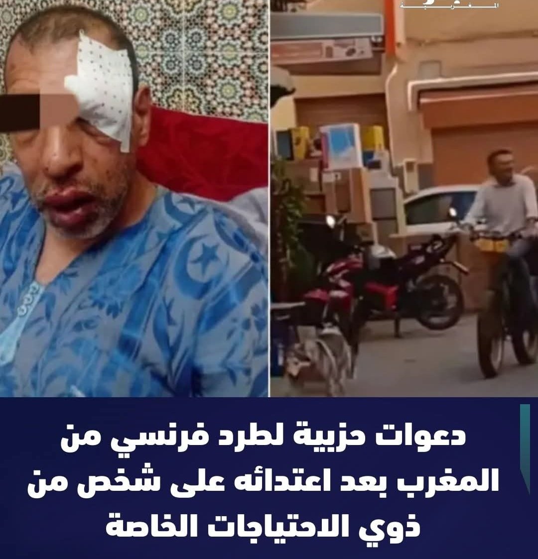 عقلتوا على الاسبان اشنو دارو للمغاربة بعد اعتداء ثلاث مراهقين على رجل سبعيني ؟
هاد الفرنسي ملقب بمول البيكالة اكثر من شهر و هو كيتسارى بربعة الكلاب و يدير الفوضى و الصداع وسط تارودانت
رغم عشرات الشكايات ديال السكان السلطة ما تدخلتش حتى وصلت بيه يتعدى على شخص معاق
#جمهورية_الموز