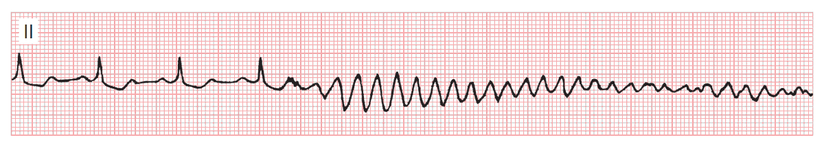 No pulse

How will you treat❓